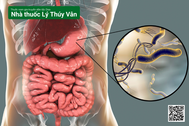 vi khuẩn Hp (Helicobacter pylori)