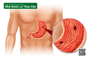 Chế Độ Ăn Cho Người Bệnh Viêm Loét Dạ Dày, Tá Tràng