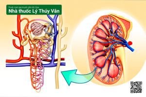 sỏi thận