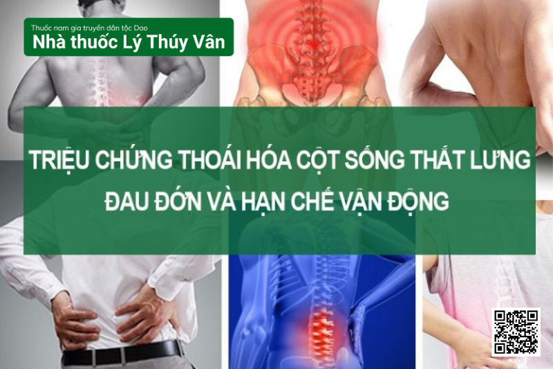 Cách Chữa Thoái Hóa Cột Sống Thắt Lưng Hiệu Quả Từ Thảo Dược