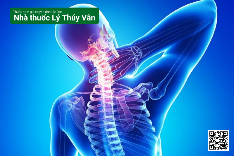 Điều Trị Thoái Hóa Cột Sống Cổ Bằng Thuốc Nam Có Tác Dụng Không?