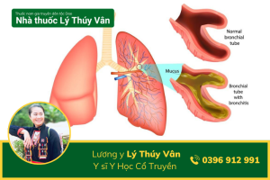 Chữa Viêm Phế Quản Theo Đông Y